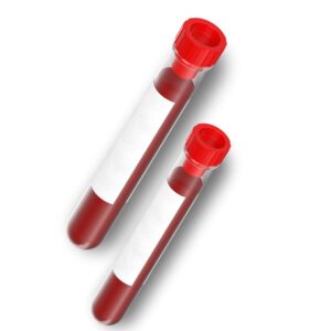 LIPIDOGRAMA